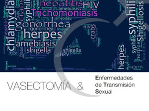 vasectomia y ets 2